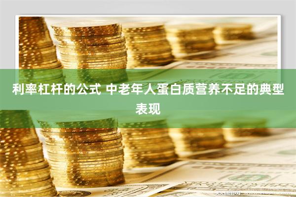 利率杠杆的公式 中老年人蛋白质营养不足的典型表现